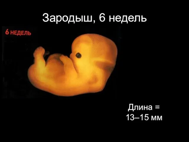 Зародыш, 6 недель Длина = 13–15 мм