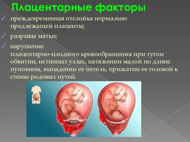 Плацентарные факторы преждевременная отслойка нормально предлежащей плаценты; разрывы матки; нарушение плацентарно-плодного кровообращения
