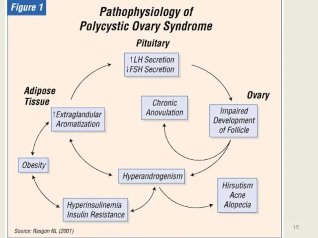 PCOS 15