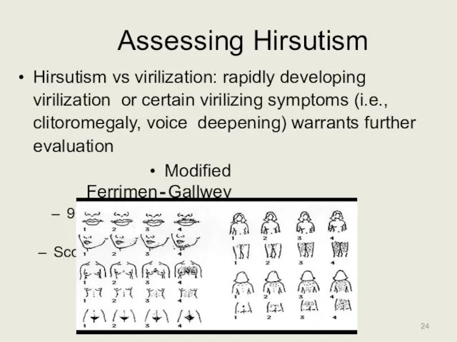 Assessing Hirsutism Hirsutism vs virilization: rapidly developing virilization or certain virilizing symptoms