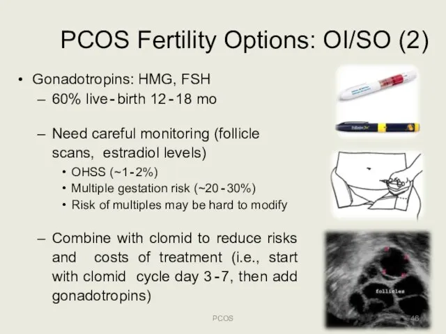 PCOS Fertility Options: OI/SO (2) Gonadotropins: HMG, FSH 60% live‐birth 12‐18 mo