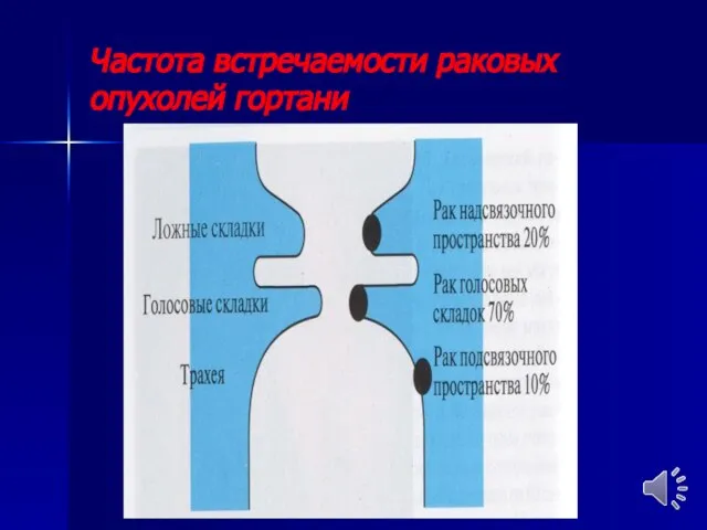 Частота встречаемости раковых опухолей гортани