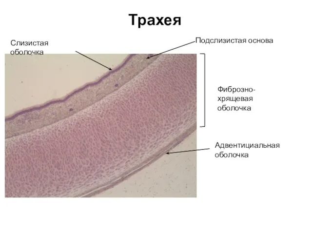 Трахея Слизистая оболочка Адвентициальная оболочка Фиброзно-хрящевая оболочка Подслизистая основа