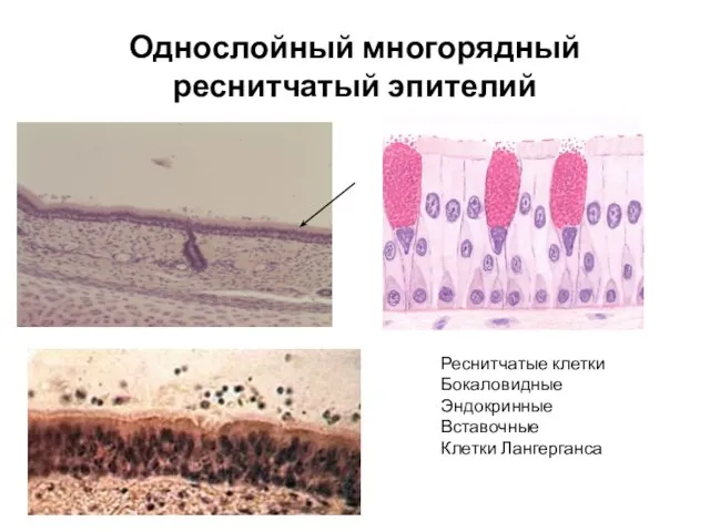 Однослойный многорядный реснитчатый эпителий Реснитчатые клетки Бокаловидные Эндокринные Вставочные Клетки Лангерганса