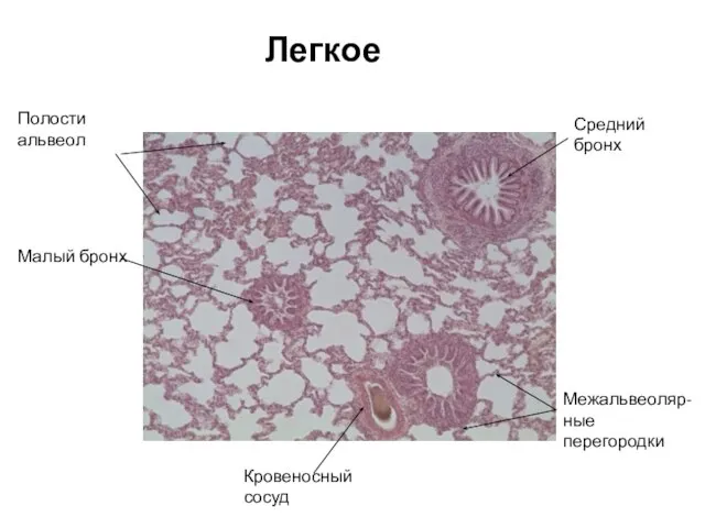 Легкое Средний бронх Полости альвеол Малый бронх Кровеносный сосуд Межальвеоляр-ные перегородки