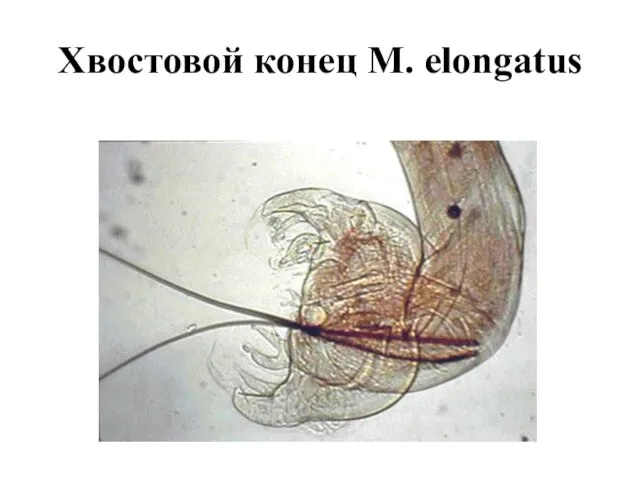 Хвостовой конец M. elongatus
