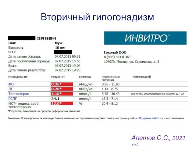 Вторичный гипогонадизм Апетов С.С., 2021 (с)