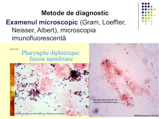 Metode de diagnostic Examenul microscopic (Gram, Loeffler, Neisser, Albert), microscopia imunofluorescentă