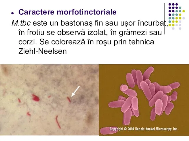 Caractere morfotinctoriale M.tbc este un bastonaş fin sau uşor încurbat, în frotiu