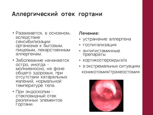 Аллергический отек гортани Развивается, в основном, вследствие сенсибилизации организма к бытовым, пищевым,