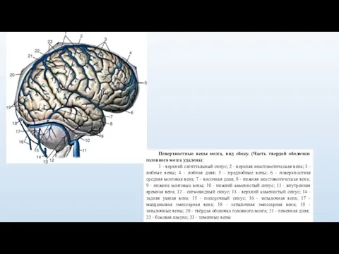 Поверхностные вены мозга, вид сбоку. (Часть твердой оболочки головного мозга удалена): 1