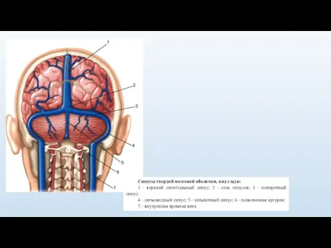 Синусы твердой мозговой оболочки, вид сзади: 1 - верхний сагиттальный синус; 2