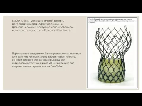 В 2004 г. были успешно апробированы ретроградный трансфеморальный и трансапикальный доступы c