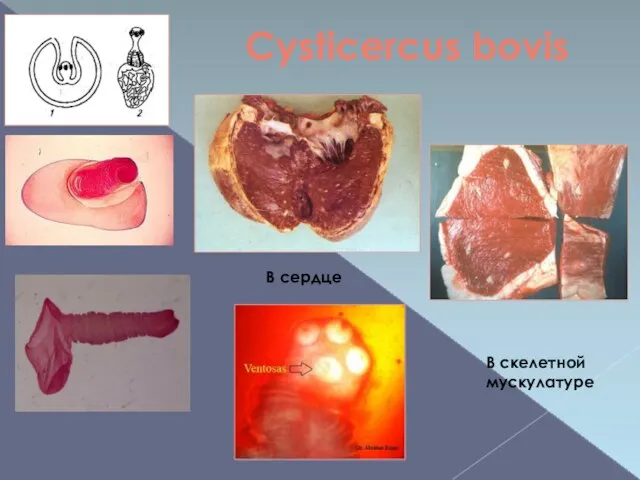 Cysticercus bovis В сердце В скелетной мускулатуре