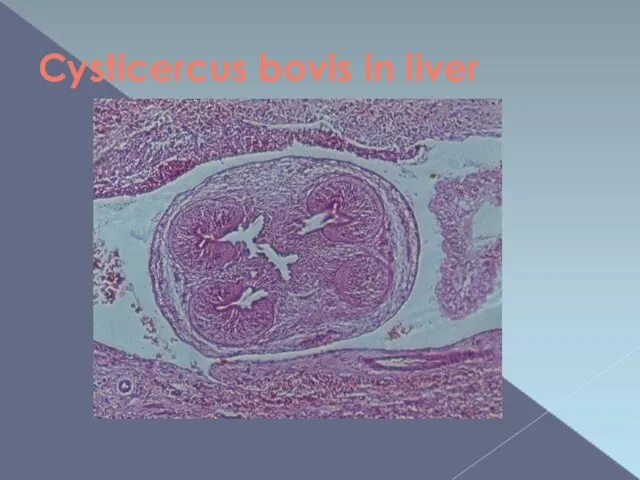 Cysticercus bovis in liver