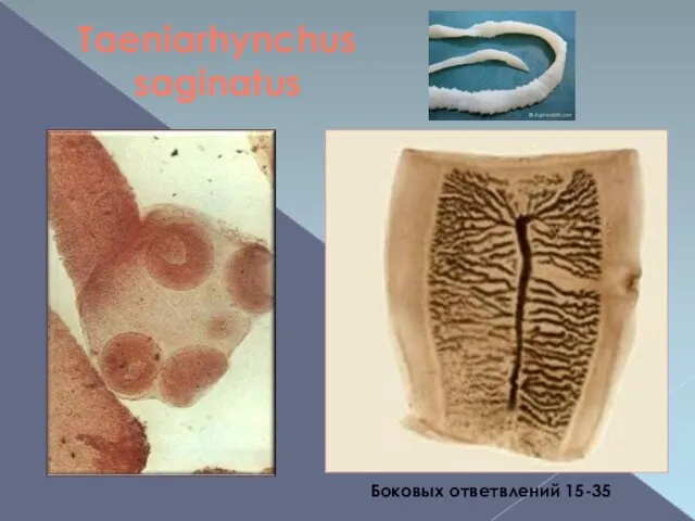 Taeniarhynchus saginatus Боковых ответвлений 15-35