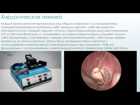 Хирургическая техника Каждая тонзиллэктомия выполнялась под общим наркозом с использованием стандартизированного протокола