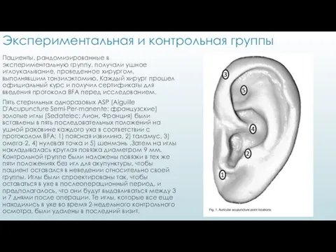 Экспериментальная и контрольная группы Пациенты, рандомизированные в экспериментальную группу, получали ушное иглоукалывание,