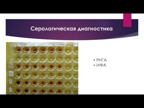 Серологическая диагностика РНГА ИФА