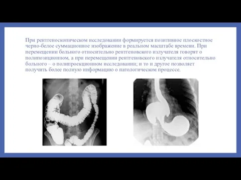 При рентгеноскопическом исследовании формируется позитивное плоскостное черно-белое суммационное изображение в реальном масштабе