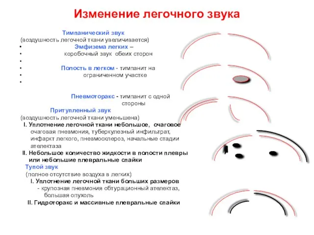 Изменение легочного звука Тимпанический звук (воздушность легочной ткани увеличивается) Эмфизема легких –