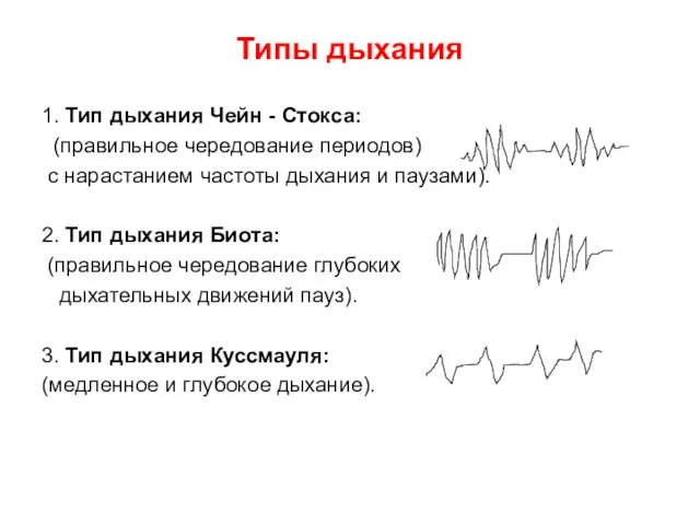 Типы дыхания 1. Тип дыхания Чейн - Стокса: (правильное чередование периодов) с