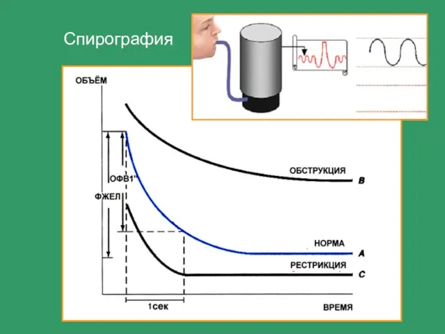 Спирография