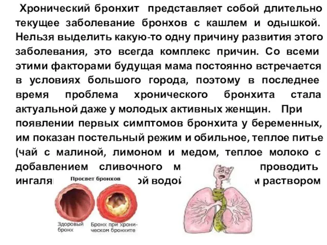 Хронический бронхит представляет собой длительно текущее заболевание бронхов с кашлем и одышкой.