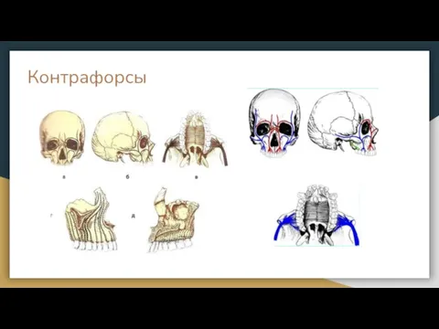 Контрафорсы