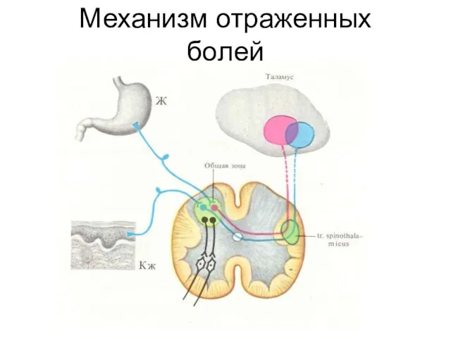 Механизм отраженных болей