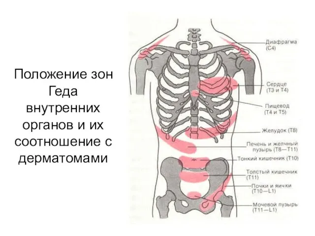 Положение зон Геда внутренних органов и их соотношение с дерматомами