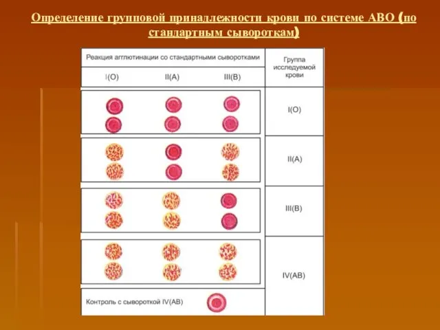 Определение групповой принадлежности крови по системе АВО (по стандартным сывороткам)