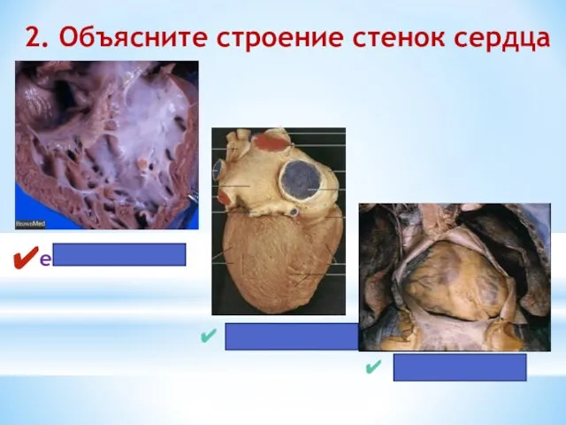 2. Объясните строение стенок сердца endocardium myocardium epicardium