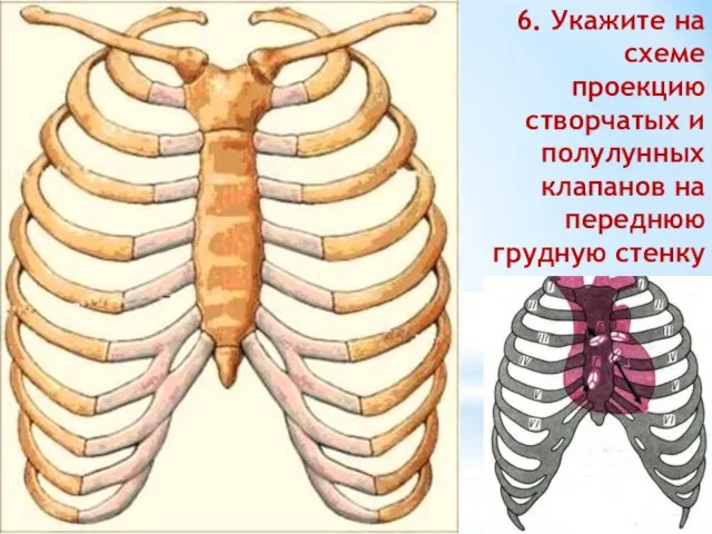 6. Укажите на схеме проекцию створчатых и полулунных клапанов на переднюю грудную стенку