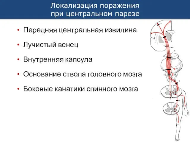 Передняя центральная извилина Лучистый венец Внутренняя капсула Основание ствола головного мозга Боковые