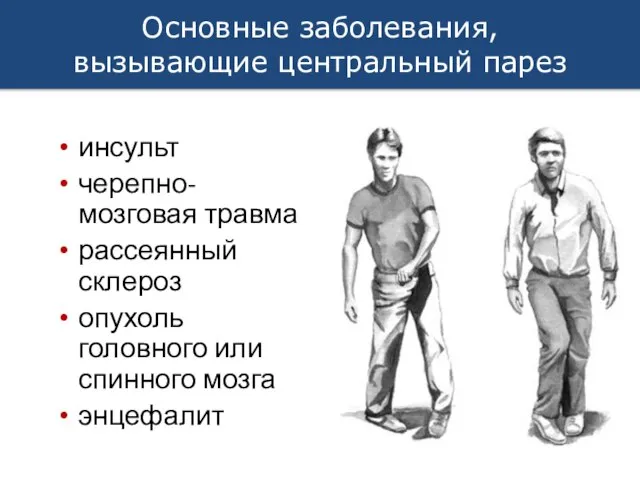 Основные заболевания, вызывающие центральный парез инсульт черепно-мозговая травма рассеянный склероз опухоль головного или спинного мозга энцефалит