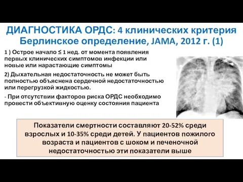 ДИАГНОСТИКА ОРДС: 4 клинических критерия Берлинское определение, JAMA, 2012 г. (1) 1