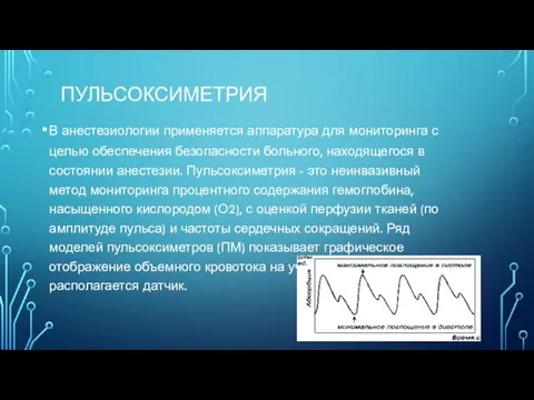 ПУЛЬСОКСИМЕТРИЯ В анестезиологии применяется аппаратура для мониторинга с целью обеспечения безопасности больного,