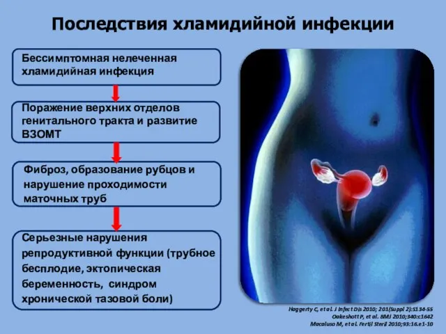 Последствия хламидийной инфекции Haggerty C, et al. J Infect Dis 2010; 201(Suppl