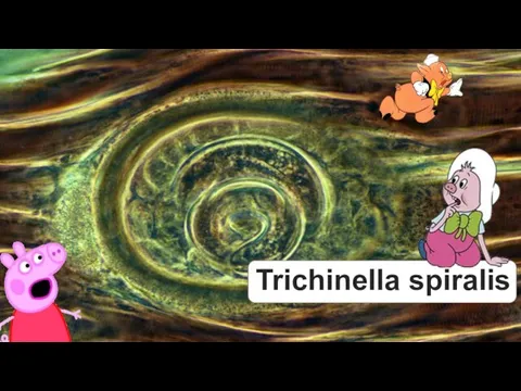 Trichinella spiralis