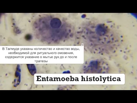 Entamoeba histolytica В Талмуде указаны количество и качество воды, необходимой для ритуального