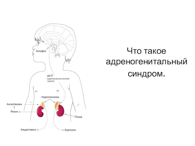 Что такое адреногенитальный синдром.