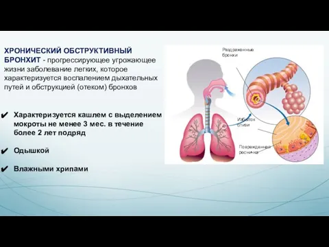 ХРОНИЧЕСКИЙ ОБСТРУКТИВНЫЙ БРОНХИТ - прогрессирующее угрожающее жизни заболевание легких, которое характеризуется воспалением