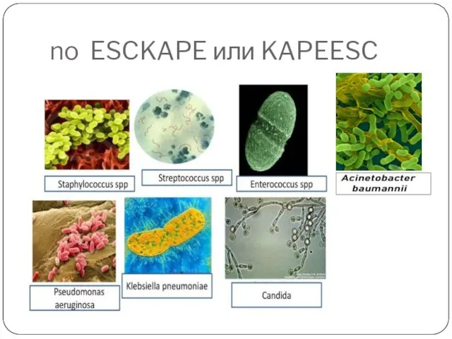 no ESCKAPE или KAPEESC