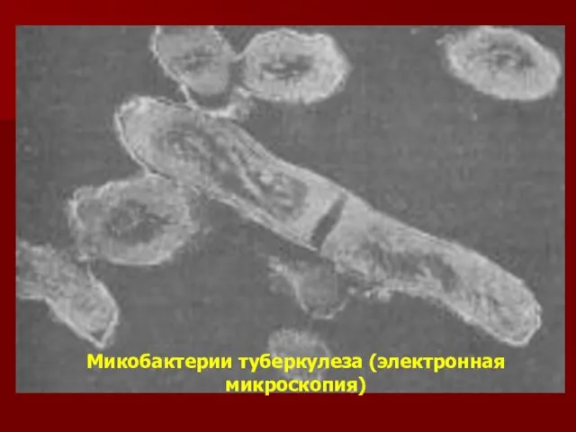Микобактерии туберкулеза (электронная микроскопия)