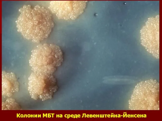 Колонии МБТ на среде Левенштейна-Йенсена