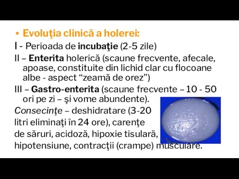 Evoluţia clinică a holerei: I - Perioada de incubaţie (2-5 zile) II