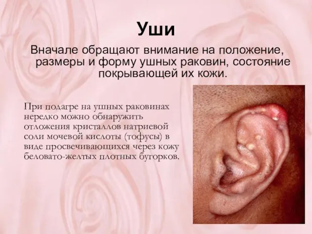 Уши Вначале обращают внимание на положение, размеры и форму ушных раковин, состояние