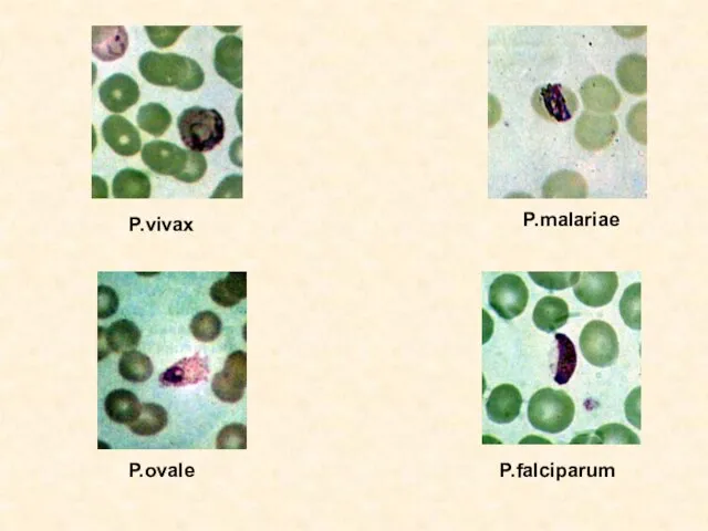 P.vivax P.malariae P.ovale P.falciparum