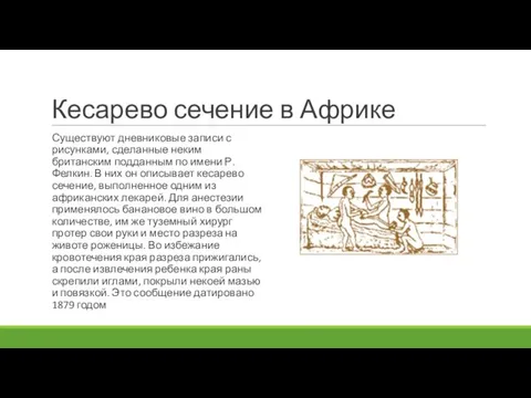 Кесарево сечение в Африке Существуют дневниковые записи с рисунками, сделанные неким британским